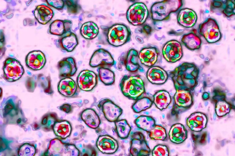 Amid Cyclosporiasis Outbreak, Measles Cases Are Nearing Last Year’s Total